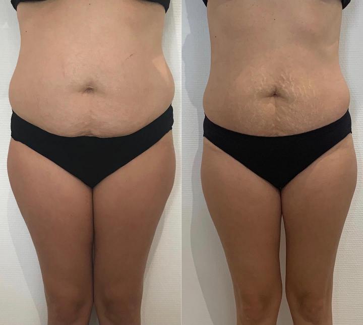 Soins pour mincir Deauville