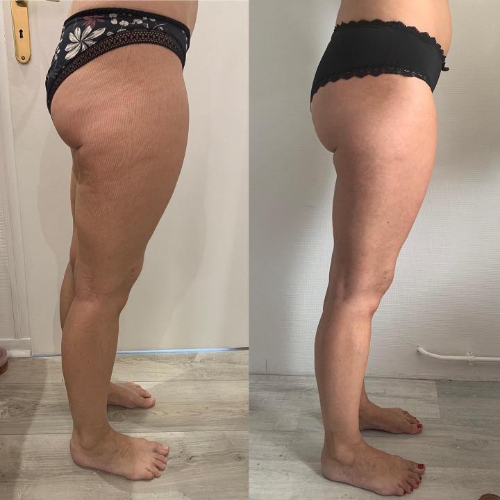 Votre lieu idéal pour des soins minceur !