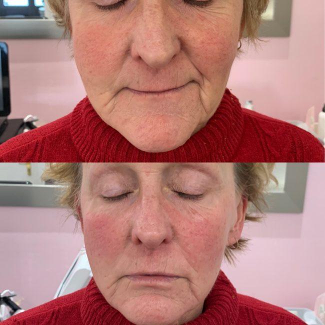 Soins du visage Deauville