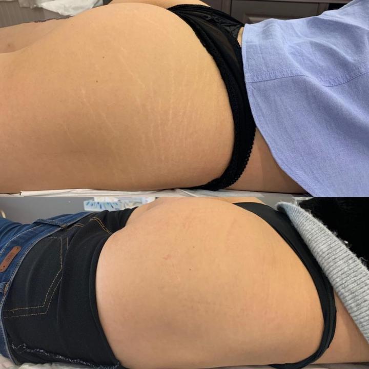 Les soins amincissants Deauville