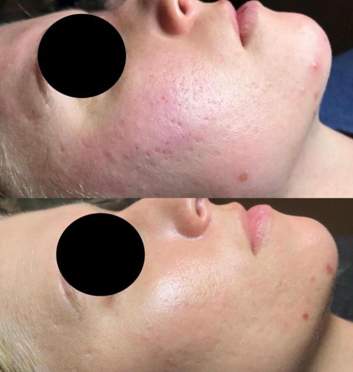 Soins du visage Deauville