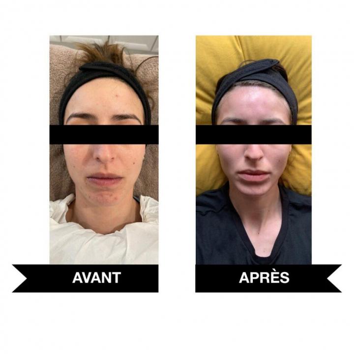 Les soins amincissants Deauville