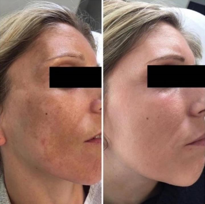 Soins du visage Deauville