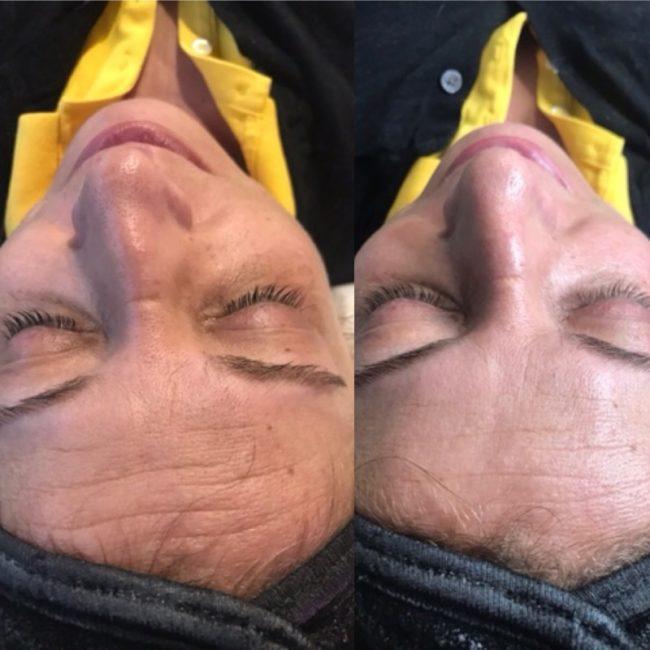 Les soins amincissants Deauville