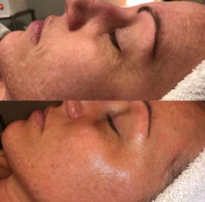 Les soins amincissants Deauville