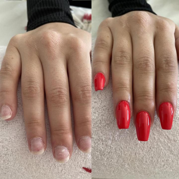 Les soins amincissants Deauville